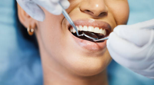 Best Teeth Whitening  in Koloa, HI